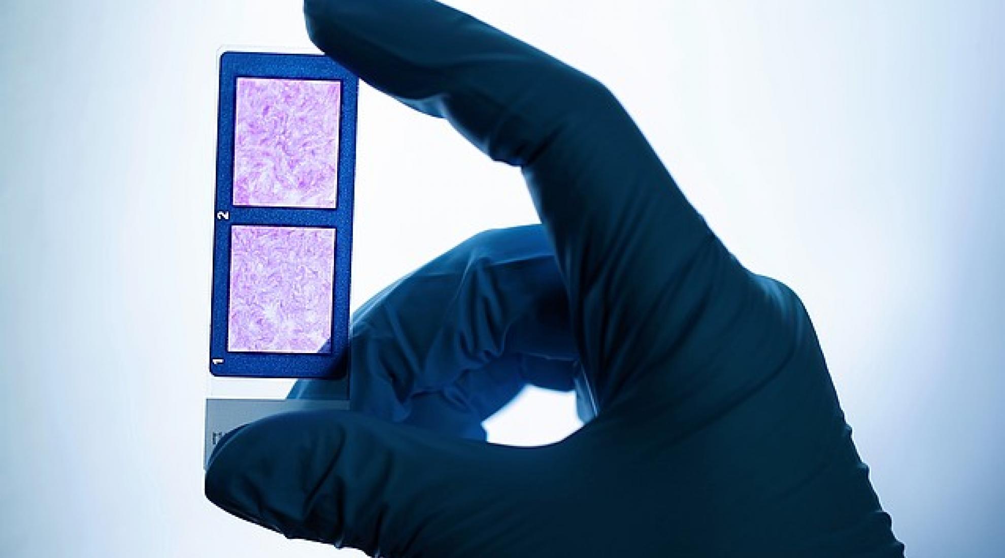 MUVON Therapeutics