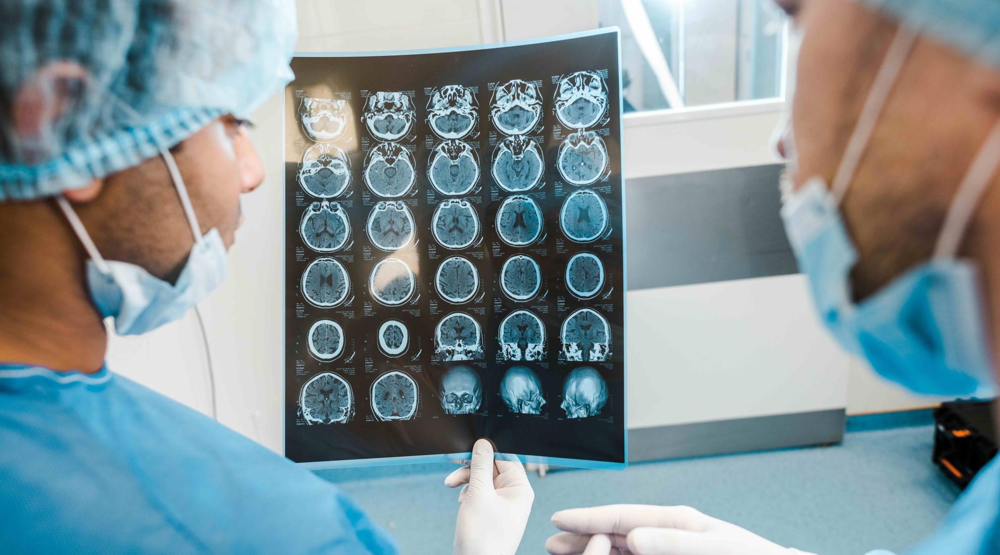 Brain tumour check