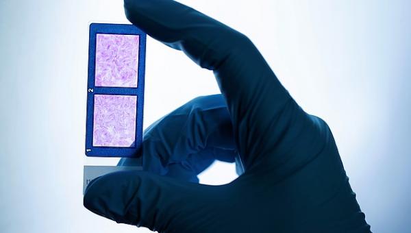 MUVON Therapeutics