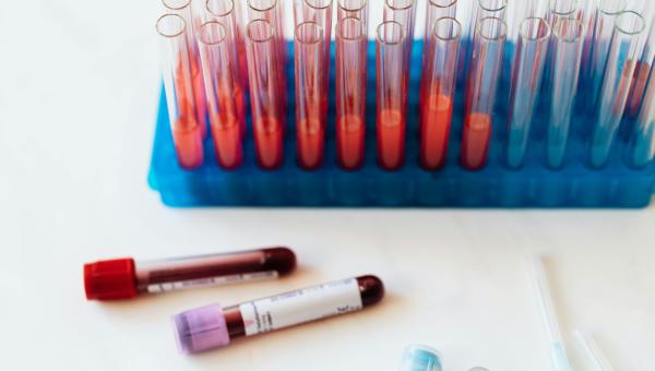Swiss start-up Xemperia is developing a type of blood test for early detection of breast cancer.
