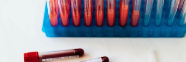 Swiss start-up Xemperia is developing a type of blood test for early detection of breast cancer.
